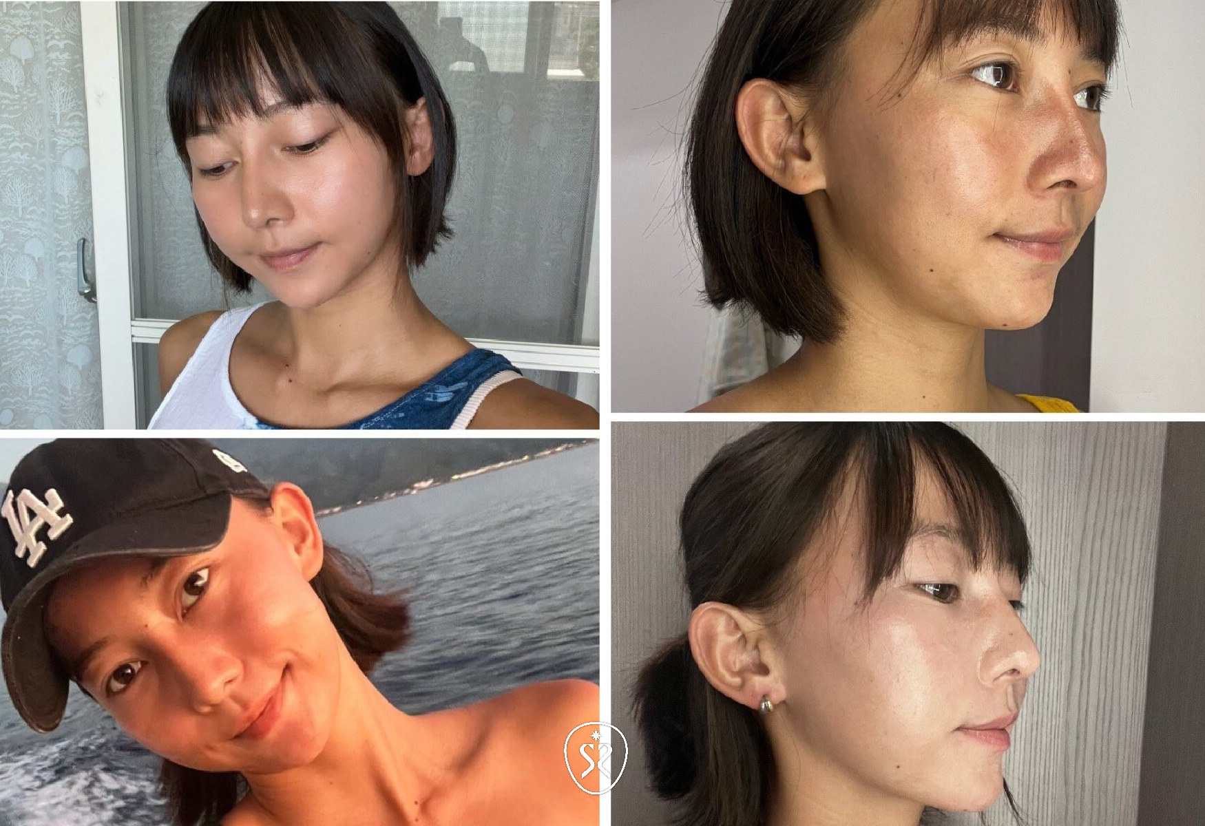 仁愛星和診所-Q+立線音波拉提緊緻下顎輪廓線條
